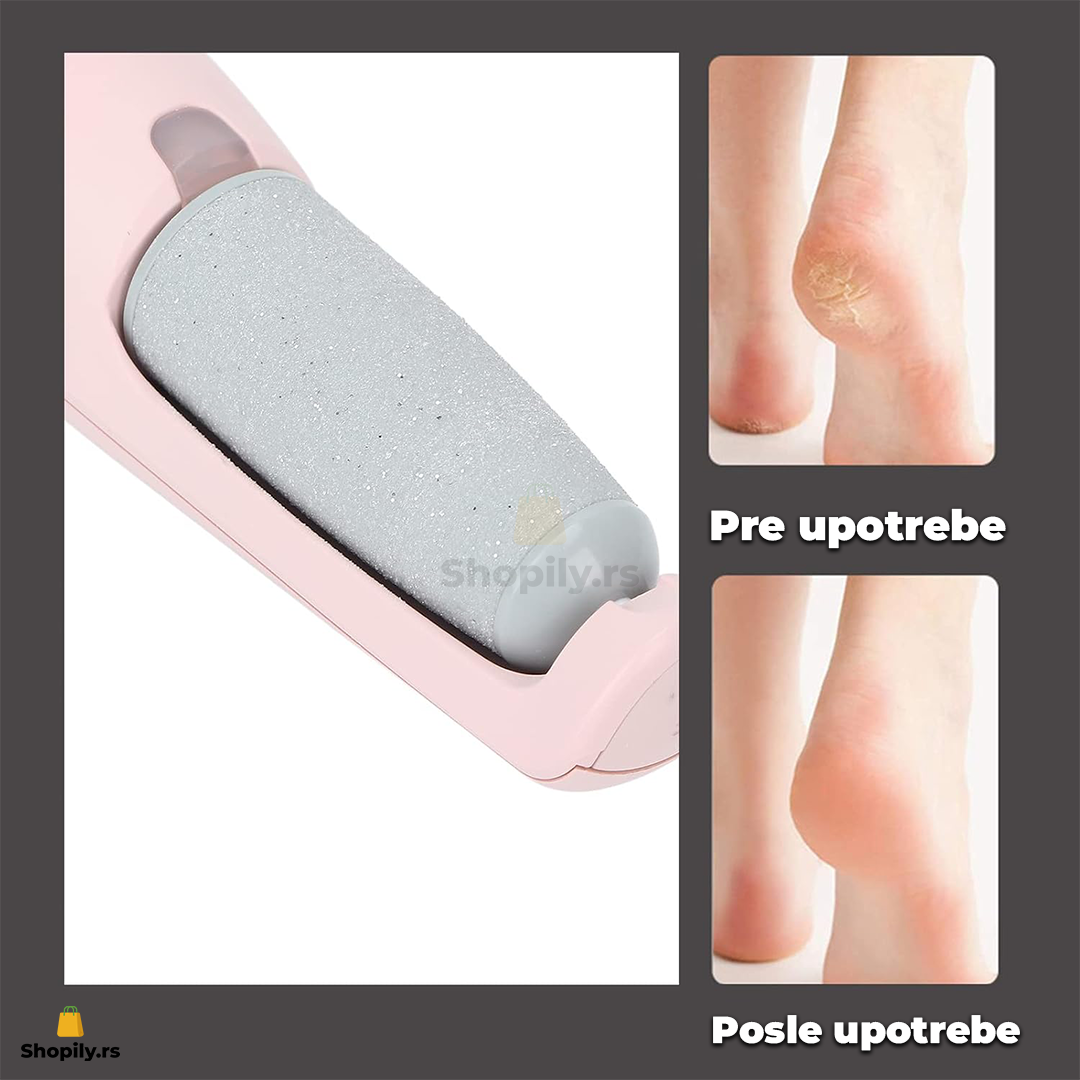 elektricna turpija za pete